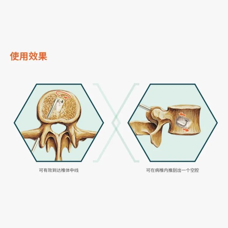 内窥镜刮匙器插图2 内窥镜刮匙器插图2