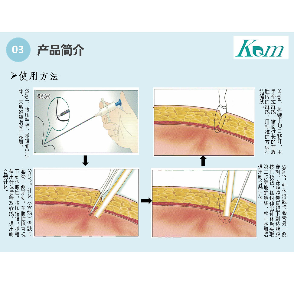 腹壁吻合器插图2