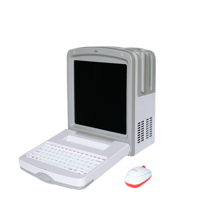 AB型眼科超声诊断仪插图1