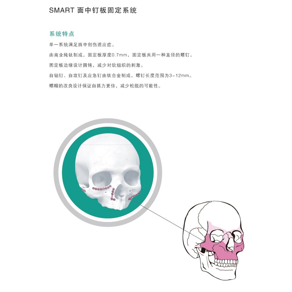 金属颅颌面接骨板插图 金属颅颌面接骨板插图